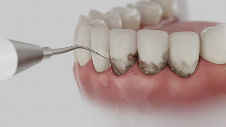 Trusted Teeth Cleaning And Checkup service in Argyle, TX - Dentist Open Now